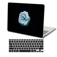 thumbnail image 1 of KSK KAISHEK Plastic Hard Case Only Compatible 2012 - 2015 Release Old MacBook Pro 15" Retina Display + Black Keyboard Cover Model: A1398 Flower 0612, 1 of 5