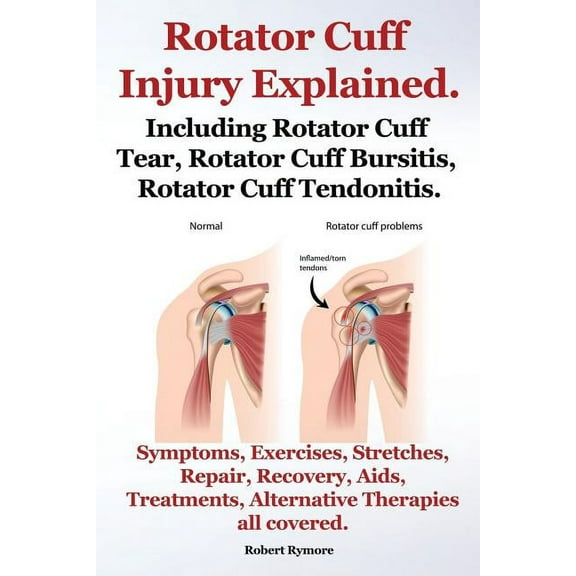 Rotator Cuff Injury Explained. Including Rotator Cuff Tear, Rotator Cuff Bursitis, Rotator Cuff Tendonitis. Symptoms, Exercises, Stretches, Repair, Re
