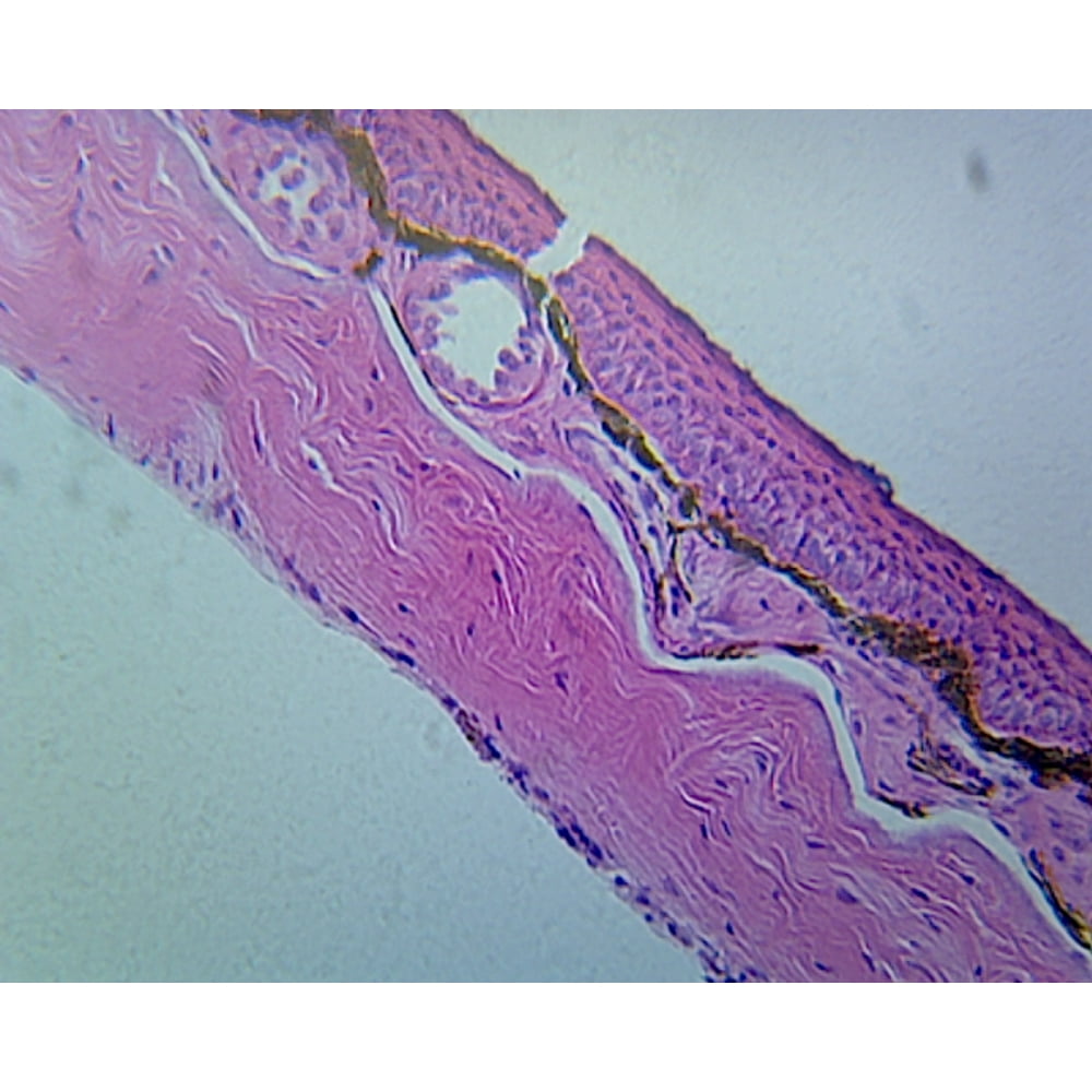 Frog Skin; Section - Walmart.com - Walmart.com