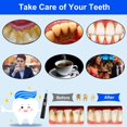 thumbnail image 5 of 1 PC Remover for Teeth, Tartar Remover for Teeth Cleaning with 4 Replaceable Heads and 3 Adjustable Modes, Rechargeable Teeth Cleaning Plaque Remover for Home pink, 5 of 7