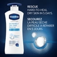 thumbnail image 4 of Vaseline Body Lotion Extremely Dry Skin Rescue 600ml, 4 of 6