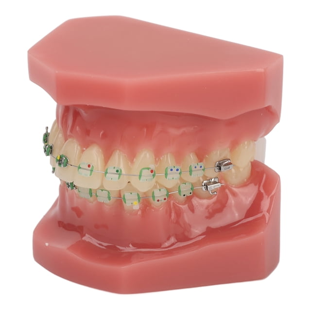 Modelo de soporte de ortodoncia dental, Modelo de demostración de ortodoncia dental Modelo de soporte de ortodoncia Modelo de demostración de ortodoncia Innovación moderna