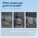 thumbnail image 4 of Gum Therapy Gel, Deep Cleaning Tooth Stains, Tartar, Sore Gums, Gum Care Dental Cleansing Gel, 4 of 4