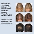 thumbnail image 4 of Laser Comb for Hair Growth, Hairmax Ultima 9 Classic FDA-Cleared Regrowth Device, Red Light Therapy, Cordless, For Men & Women, 4 of 9