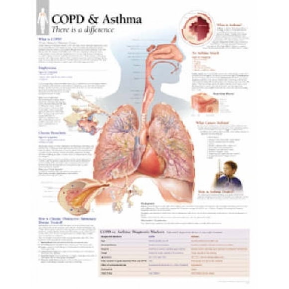 Publishing, S: COPD & Asthma Laminated Poster