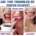 thumbnail image 1 of Brightening Toothpaste for Stain Removal and Gum Care, Fluoride-Free Formula Fights Tartar, Freshens Breath, Supports Dental Health, 1 of 2