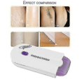 thumbnail image 2 of Épilateur Indolore avec Micro Vibration Seu Plug, 2 of 4