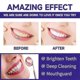 thumbnail image 5 of 1Bottles Teeth Whitening Powder Remove Tooth Stain, 5 of 5