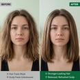 thumbnail image 2 of Botanic Hearth Tea Tree Shampoo and Conditioner Set infused with Vegan Collage, 16 fl oz each - Sulfate & Paraben Free - for Itchy and Dry Scalp - Men and Women, 2 of 11