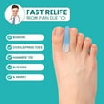 thumbnail image 2 of 12-Pack Gel Toe Separators - Bunion Pads – Toe Spacers for Overlapping Toes Straightening for Men and Women (4L+8S, Transparent Blue), 2 of 7