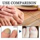thumbnail image 4 of Nail Repairing Liquid, Speedy and Effective Approach to Toenail Issues - Combating Thick, Discolored Nails - Powerful Solution for Addressing Yellow a, 4 of 4