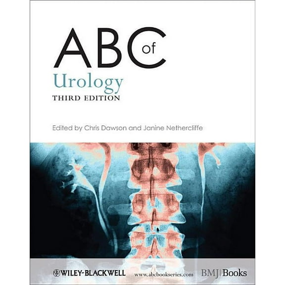 ABC ABC of Urology 3e, Book 171, (Paperback)