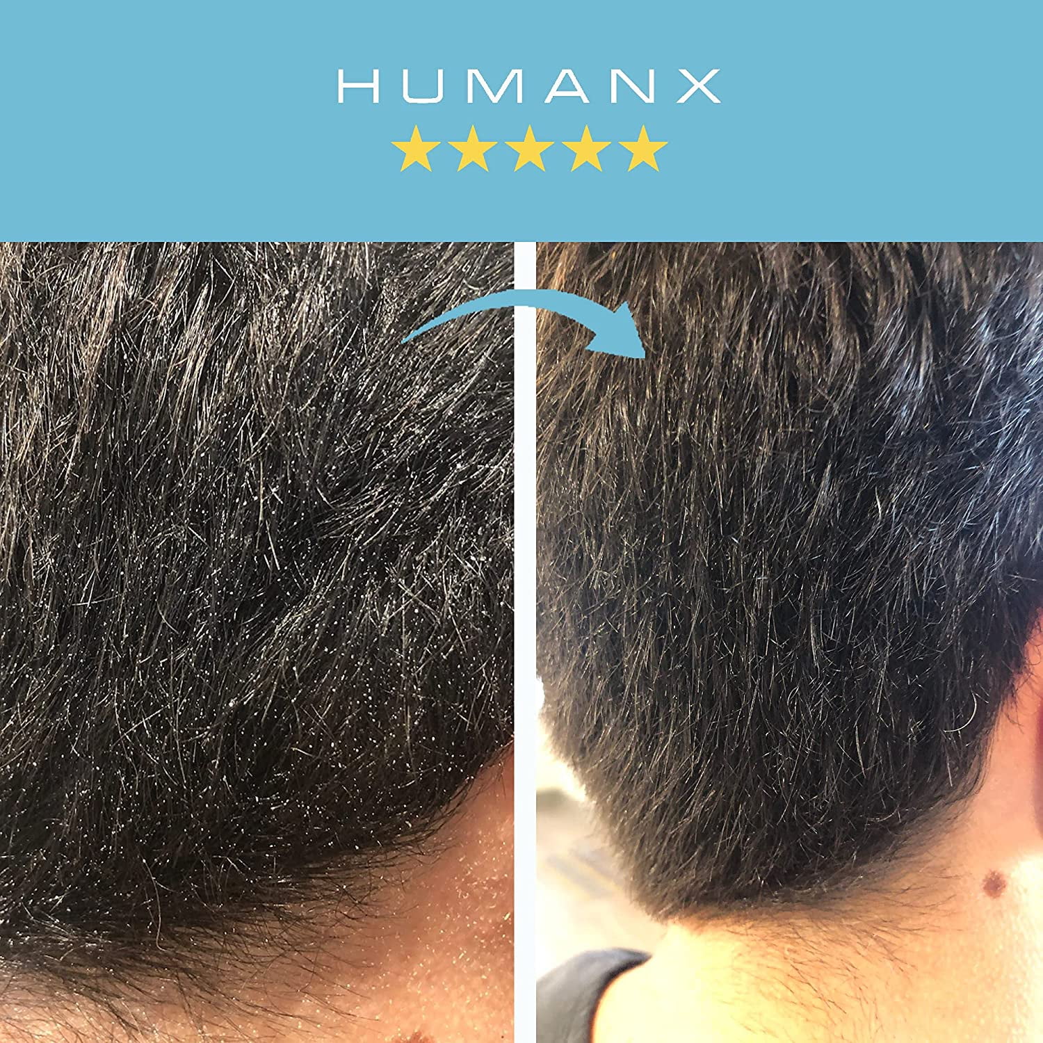 Buy Dandrisil Anti Dandruff Treatment and Scalp Care (for Men & Women