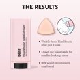 thumbnail image 4 of Bliss Blackhead Breakdown™ Blackhead Purifying Facial Treatment Stick with Pink Clay, 30+ Uses, 0.53oz, 4 of 10