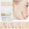 moisturizing Exfoliator Dermatologist Scar Removal Stretch Marks And