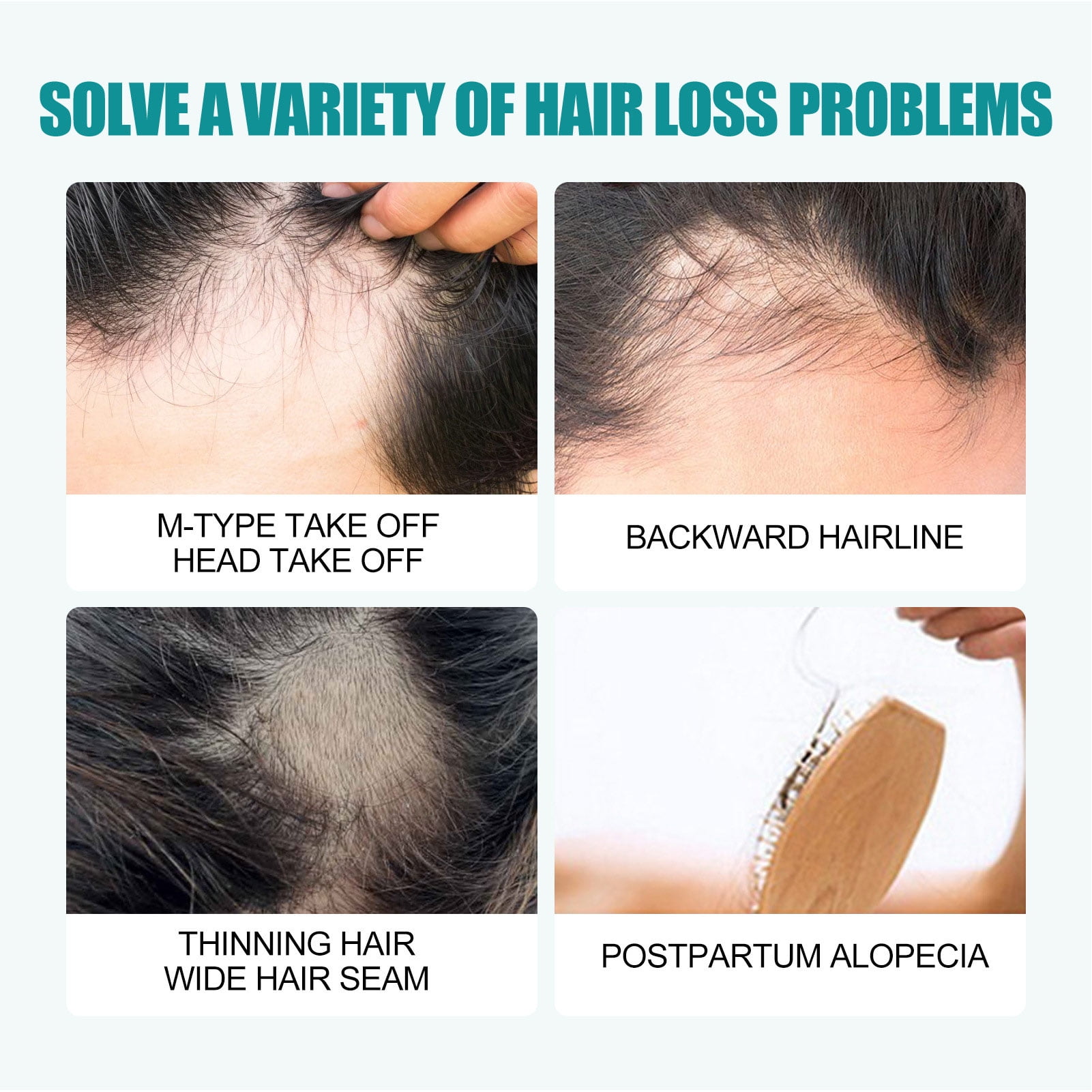 Hair Root Strengthen Serum, Hair Regrowth Serum 2pcs 60ml