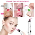 thumbnail image 2 of BESTOPE Blackhead Remover Vacuum, Skin Vacuum Pore Cleaner Blackhead Removal Tool Electric Acne Comedone Suction Device with IPL Beauty Lamp 4 Blackhead Extractor Tool for All Facial Skin Treatment, 2 of 8