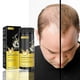 thumbnail image 2 of Ginger black hair care powder moisturizing nutrition strong anti-breakage hair thickening ginger hair care powder 8g box, 2 of 3