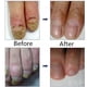 thumbnail image 5 of 10ml antihongos para el cuidado de los pies eliminación de hongos infección máxima fuerza tratamiento de uñas para reparación de hongos en los pies a base de hierbas ANGGREK Otros, 5 of 5