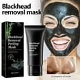 thumbnail image 1 of Mascarilla facial para eliminar puntos negros con ingredientes naturales que penetran fácilmente en los poros y eliminan los puntos negros., 1 of 9