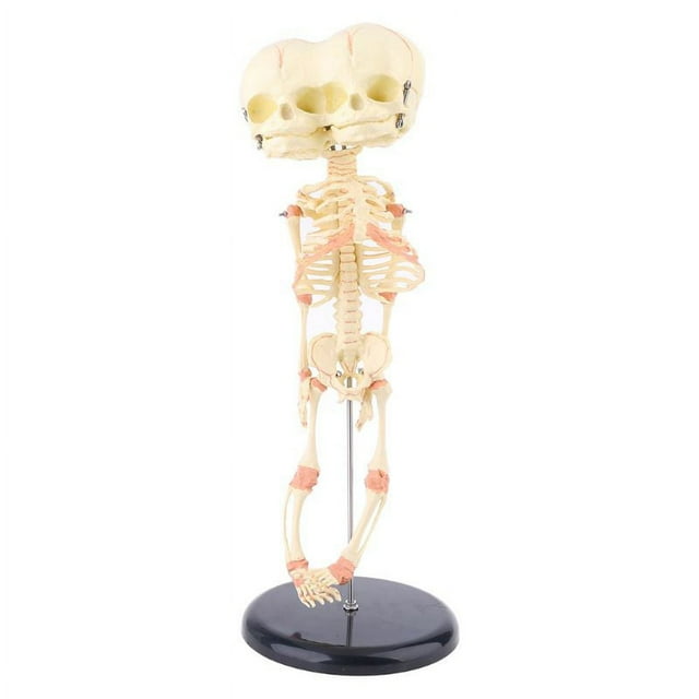 HLONK Human Baby Deformed for Head Skull Research Model Skeleton Anatomical Brain Anatomy Teaching Study Display