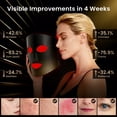 thumbnail image 2 of Morfone Red Light Therapy Mask for Face, 4 Modes LED Face Mask, 850NM Infrared & Red Light Mask, 400 LEDs, Eye Protection & Timing Function at Home, Travel, 2 of 10