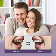 JARENGO Fake Teeth, 4PCS Dentures Teeth for Women and Men Veneers for Temporary Teeth Restoration Nature and Comfortable to Protect Your Teeth