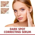 Dark Spot Correcting Serum Niacinamide Serum for PostAcne Marks, Acne