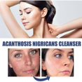 thumbnail image 3 of Black Acanthus Facial Cleanser Deep Cleansing, Softening, Skin Repair, Fading Facial Dullness, Whitening Facial Clea, 3 of 4