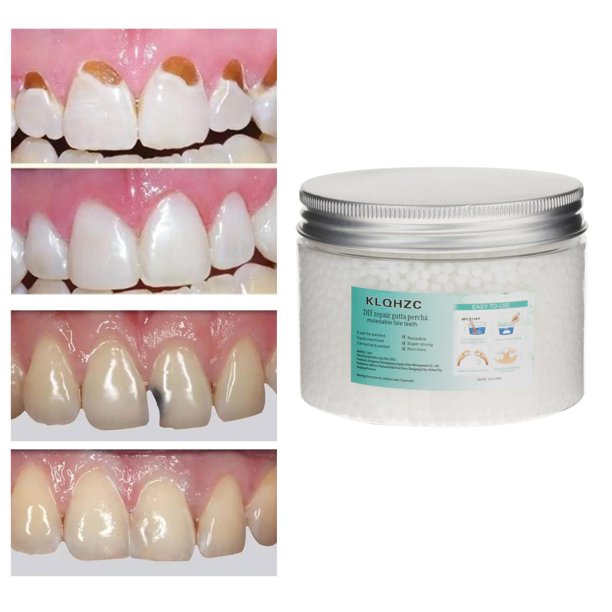Temporary Tooth Filling Repair Kit Thermal Beads Solid Glue For Teeth