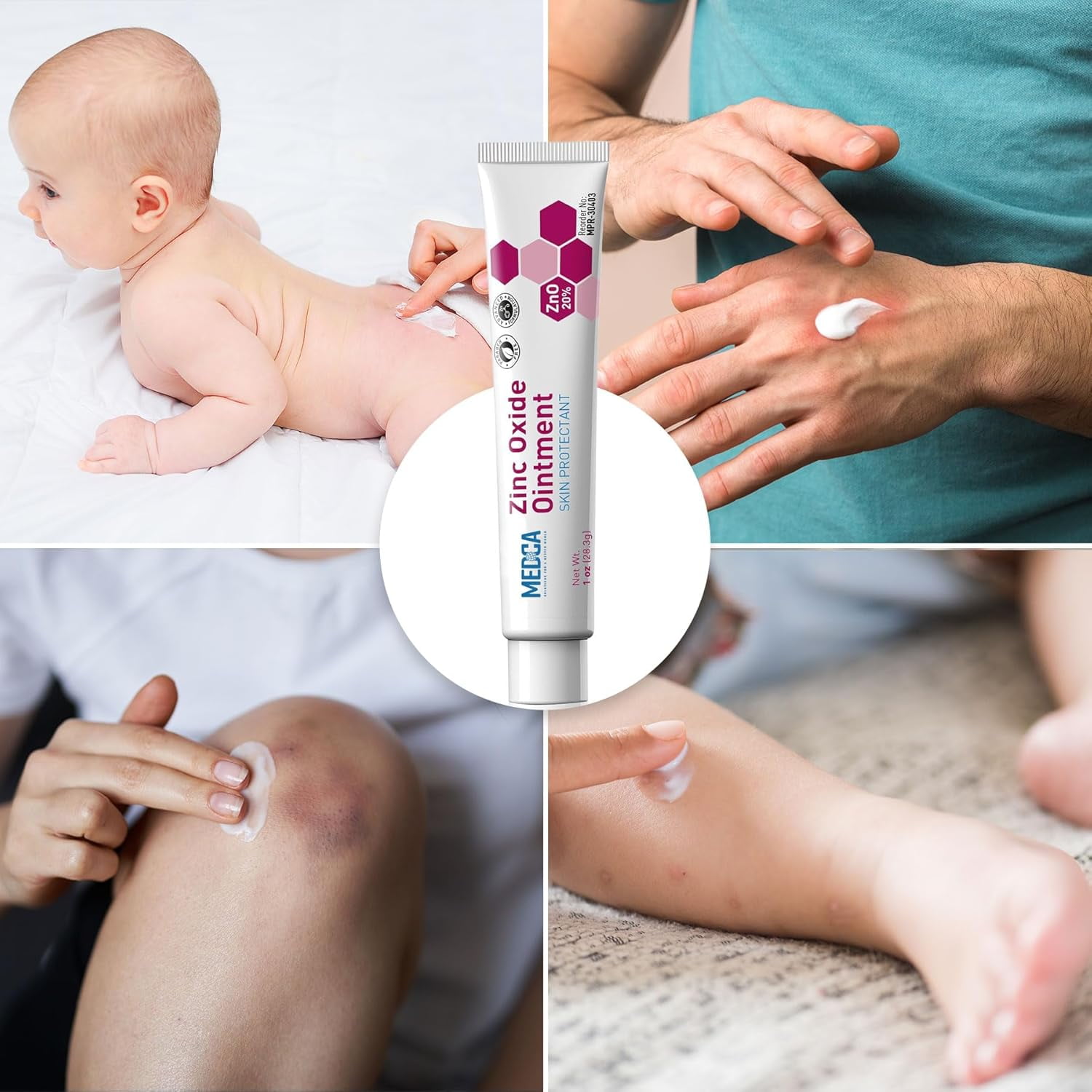 MEDca High-Potency 20% Zinc Oxide Ointment - Baby Diaper Rash Cream (Pack of 24, 1oz Tubes), Soothing, Hypoallergenic, Gentle Skin Protectant for Chafed Skin, Wetness & Overnight Protection, All Ages