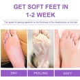 thumbnail image 3 of Milk Foot Peel Mask by - Feet Peeling Mask for Repair Rough Heels and Remove Dead Skin & Callus, Enjoy Baby-soft and Smooth Feet, Exfoliating Foot Mask for Dry Cracked Feet - 5 Pack, 3 of 8