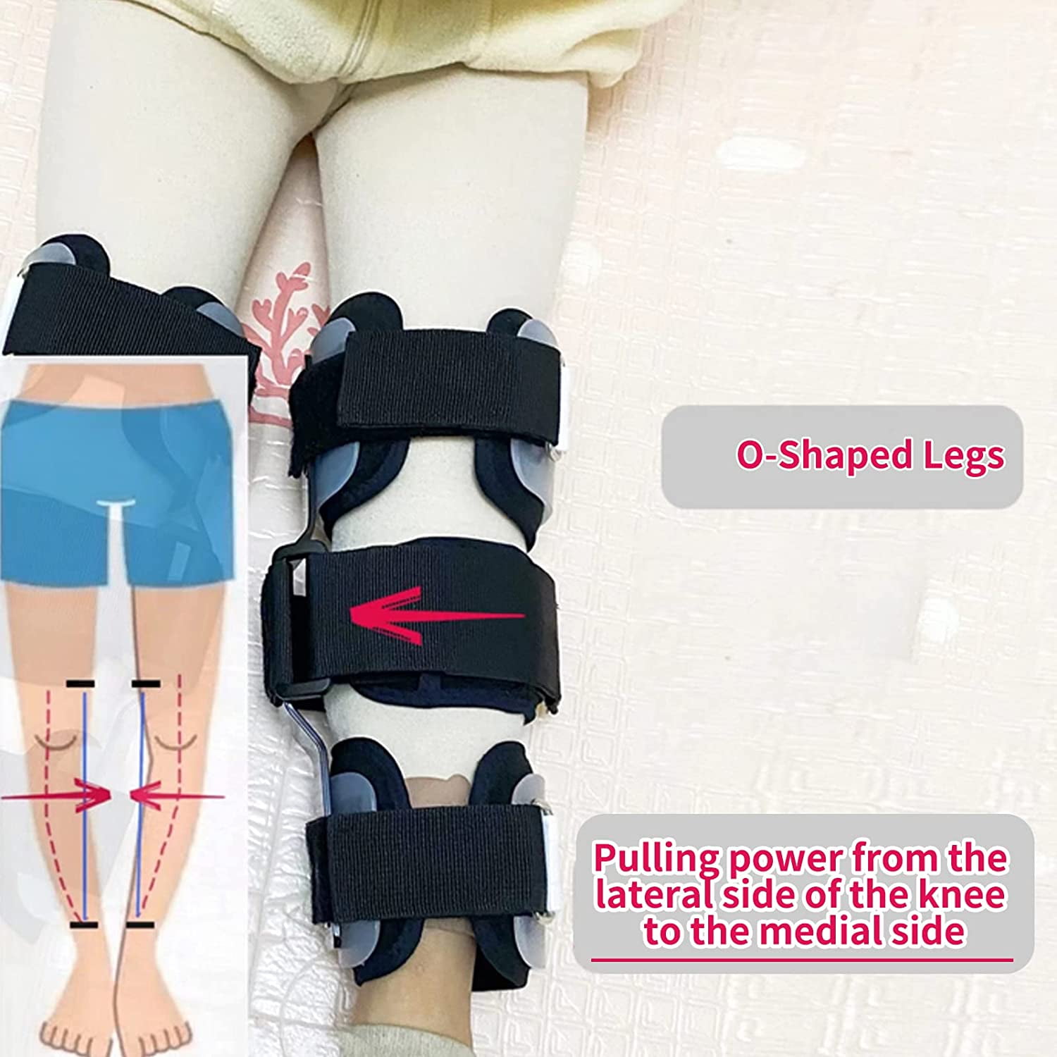 GHORTHOUD Kids Knock Knee Brace Children Bow Leg Correct OX Leg Orthosis Posture Corrector Brace