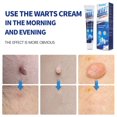 Wart Removal Ointment Body Warts Removal Cream Plantar Warts Ointment