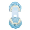 thumbnail image 4 of Modelo patológico Dental enseñanza clara modelo de exhibición de dientes dentales desmontable azul transparente, 4 of 8