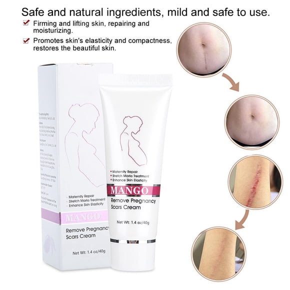 Crema Reparadora Postparto, Crema Estrías 40g Para Exterior