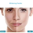 thumbnail image 4 of Crema Blanqueadora Para Aliviar El Melasma Y Las Manchas Oscuras, 4 of 4