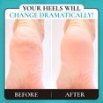 thumbnail image 5 of Lima para pies, depurador de pies de doble cara, herramienta de pedicura para el cuidado de los pies, se puede utilizar Lima de acero inoxidable para piel húmeda o seca, 5 of 5