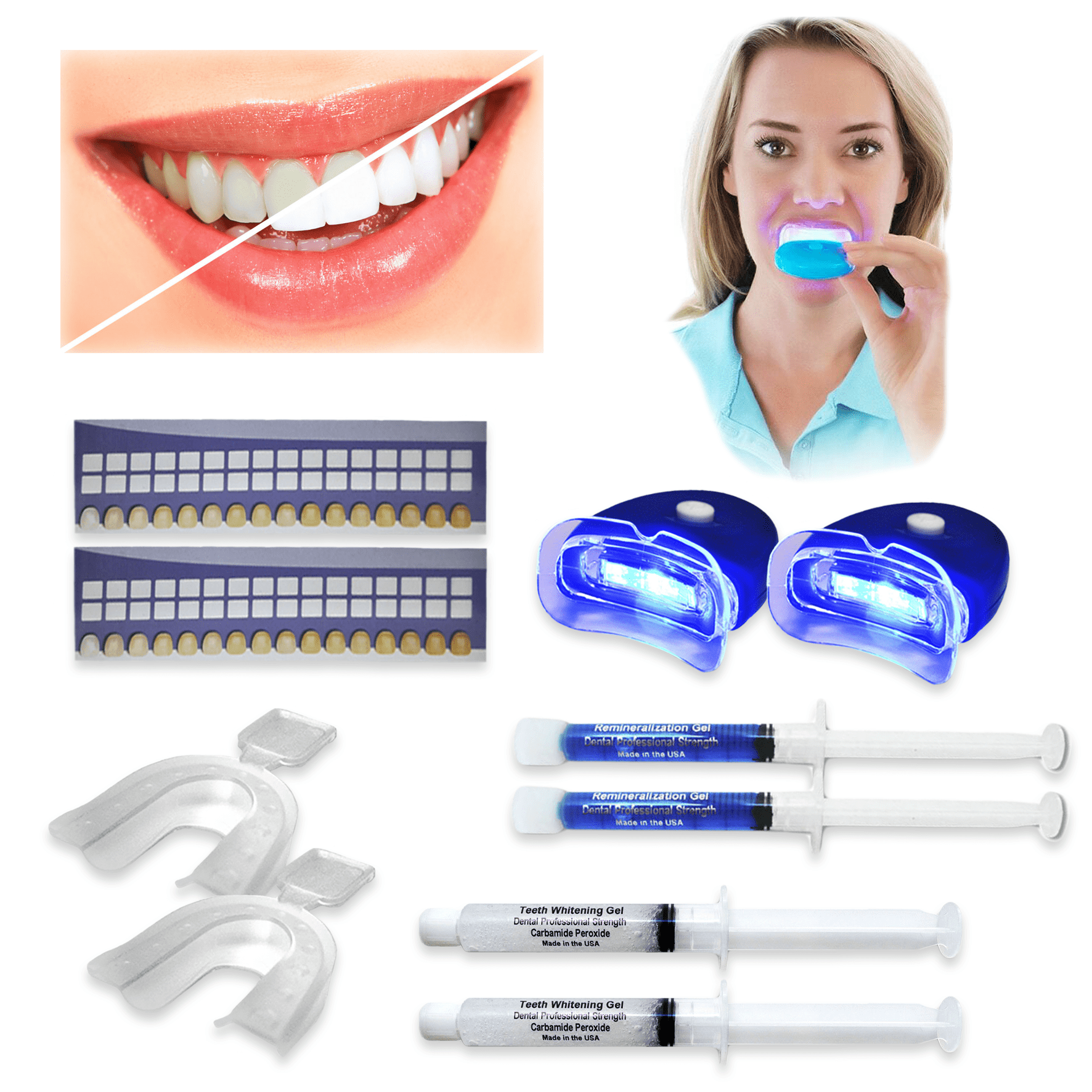 Always White Premium Teeth Whitening Kit for Two - 35% Whitening Gel Syringes - Made in USA