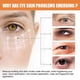 thumbnail image 4 of Crema para Ojos En Barra con Vitamina C: Reduce Bolsas y Líneas Finas | Patas de Gallo | Reafirma La Piel | Barra de 4 G | Hidrata | Reduce Ojeras, 4 of 7