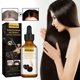 thumbnail image 1 of 3 uds. La esencia para el cuidado del cabello antipérdida de 30 ML promueve un suero para el cabello más grueso, 3 uds. Ygjytge Para estrenar, 1 of 9
