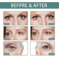 thumbnail image 3 of Anti-Wrinkle Eye Cream Care For Skin Around The Eye To Reduce Dark Spots Dry Line Fine Line Tighten, 3 of 3