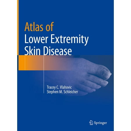 UPC: 9783031079498 | Atlas of Lower Extremity Skin Disease (Hardcover)