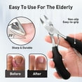 thumbnail image 6 of Toenail Clippers, Nail Clippers Set for Ingrown or Thick Toenails, Sharp Curved Blade Pedicure Tool for Men Seniors, 6 of 6