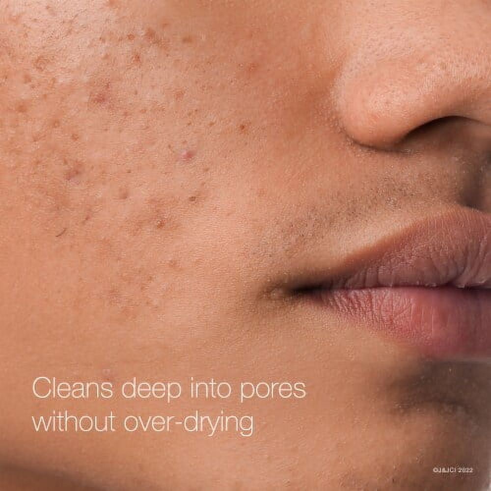 Neutrogena Rapid Clear Maximum Strength Acne Face Pads with 2% Salicylic Acid Acne Medication 60 ct