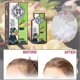 thumbnail image 2 of 2025 Ginger Plant Extract Anti-hair Loss Hair Shampoo, 2024 New Ginger Plant Extract Anti-hair Loss Hair Shampoo, Ginger Shampoo For Hair Growth, 2 of 5