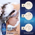 thumbnail image 5 of Champú antifúngico Uttse para la psoriasis del cuero cabelludo, 300 ml, 5 of 5