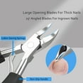 thumbnail image 2 of Toenail Clipper Ingrown Nail Pedicure Knife for Ingrown Nails Removal Kit Thick Nail Cutter Toenail Treatment Correction, 2 of 7