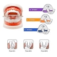 thumbnail image 1 of Dental Tooth Orthodontic Appliance With Denture Case Teeth Alignment, Dental Appliance, Orthodontic Appliance, Trainer, Dental Appliance, Aligner, 1 of 5