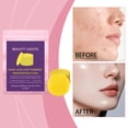 thumbnail image 4 of Toallitas faciales limpiadoras con cúrcuma y kojic | Toallitas exfoliantes suaves y humectantes para limpieza profunda de poros | Fórmula iluminadora, antioxidante y calmante | Suaves y aptas para, 4 of 9